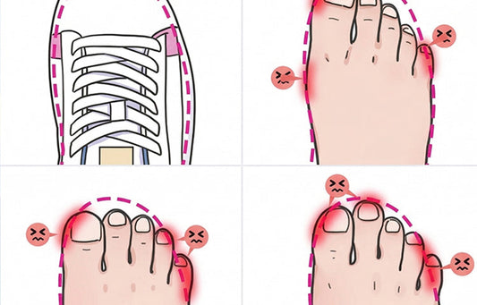 Your Feet Are the 'Magnifying Glass' of Your Health: 4 Warning Signs You Shouldn't Ignore